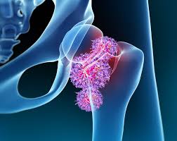 Orthopedic Treatment In Tambaram
